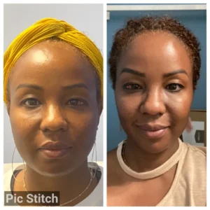 before-after-10