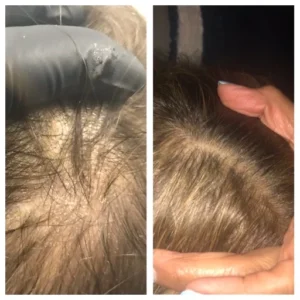 before-after-11