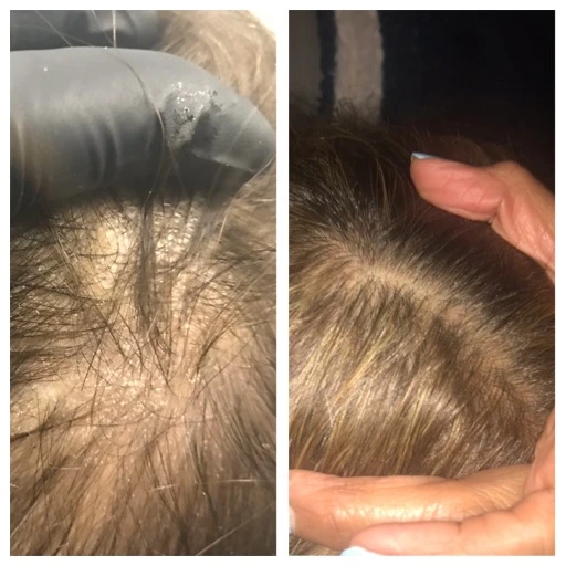 before-after-11