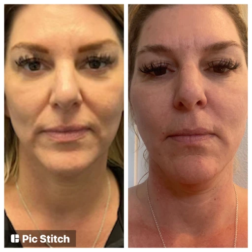 before-after-14