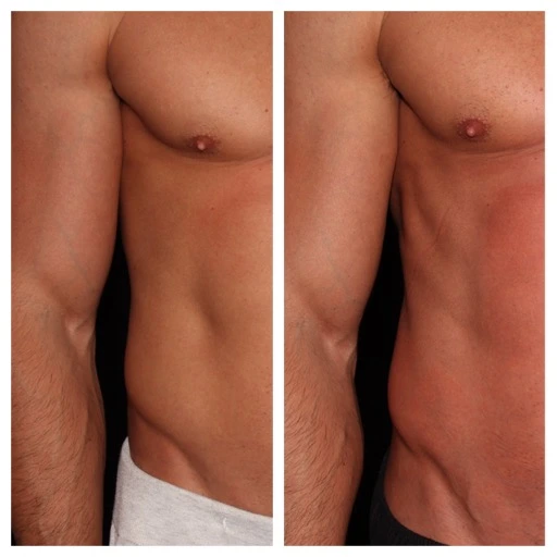 before-after-2