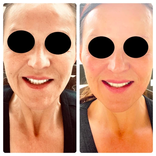 before-after-20