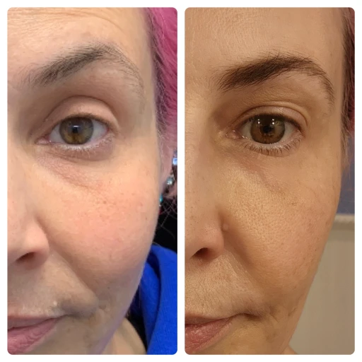 before-after-21