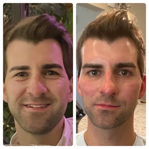 before-after-3