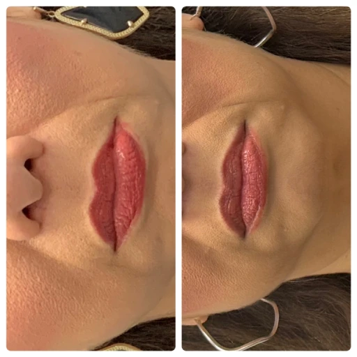 before-after-9