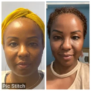 before-after-10.webp