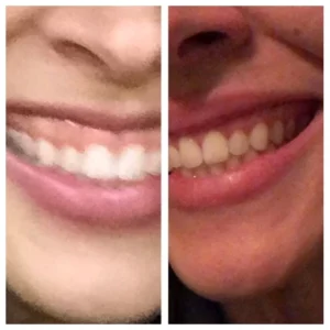 before-after-12.webp