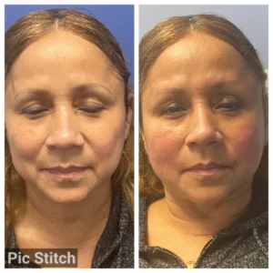 before-after-13.webp
