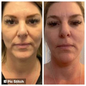 before-after-14.webp