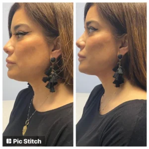 before-after-16.webp