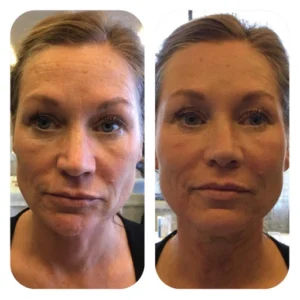 before-after-17.webp