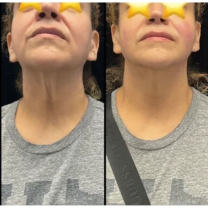 before-after-18.webp