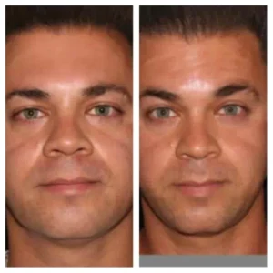 before-after-19.webp
