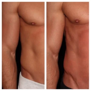 before-after-2.webp