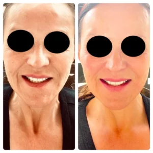 before-after-20.webp