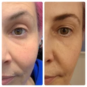 before-after-21.webp