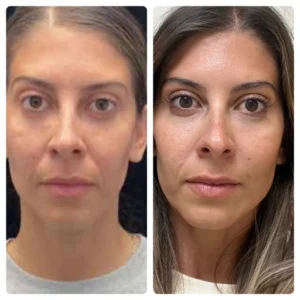 before-after-22.webp