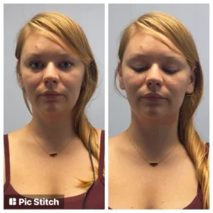 before-after-23.webp