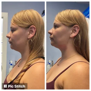 before-after-24.webp