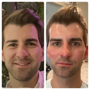 before-after-3.webp