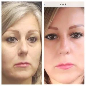 before-after-7.webp