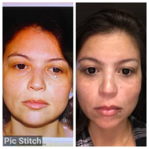 before-after-8.webp