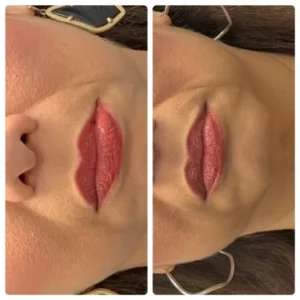 before-after-9.webp