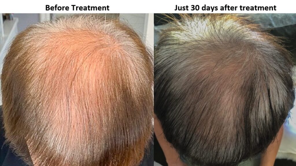 Edans Med Spa Hair Restoration