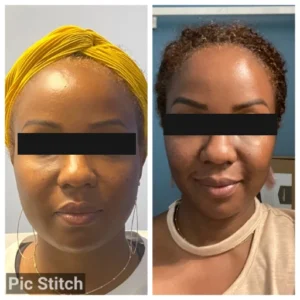 before-after-10