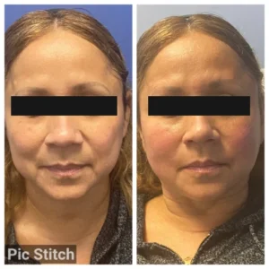 before-after-13