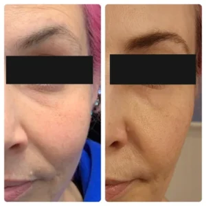 before-after-21