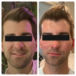 before-after-3
