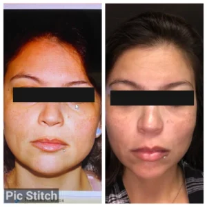 before-after-8