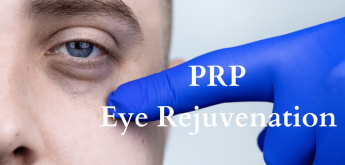 PRP eye rejuvenation treatment close up.